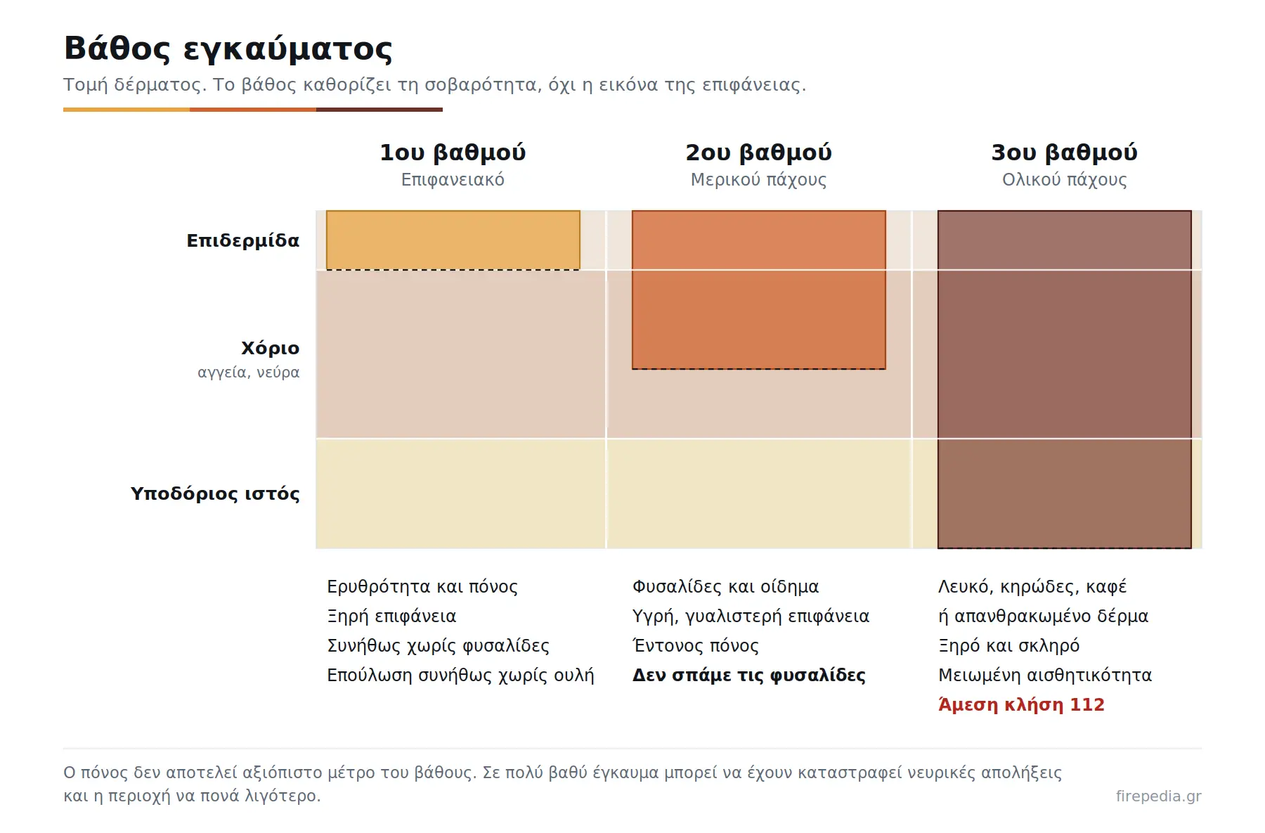 Βάθος εγκαύματος: 1ου, 2ου και 3ου βαθμού Τομή δέρματος που δείχνει το βάθος εγκαύματος 1ου, 2ου και 3ου βαθμού σε επιδερμίδα, χόριο και υποδόριο ιστό